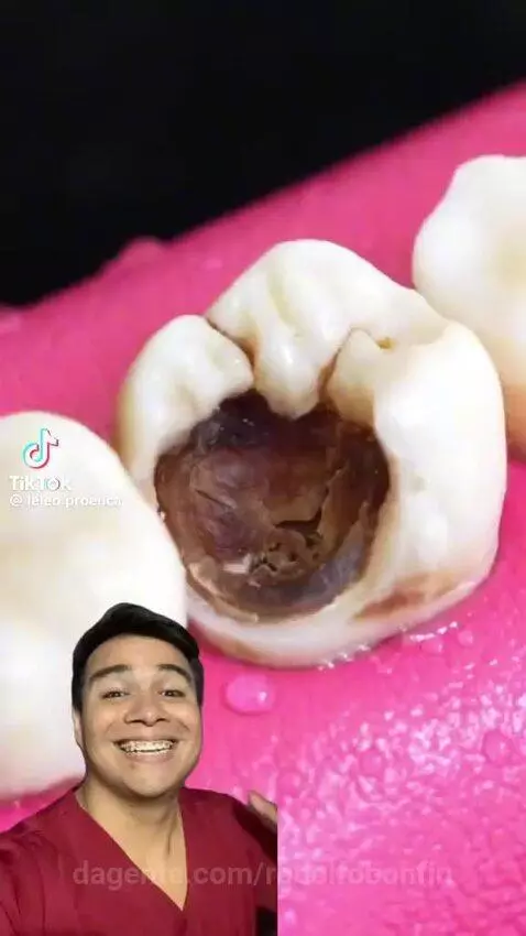 video poster