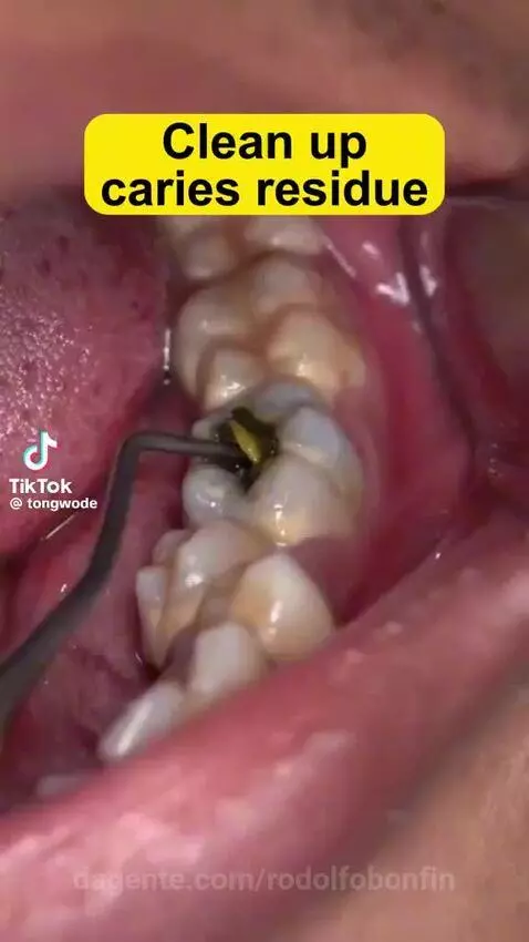 video poster