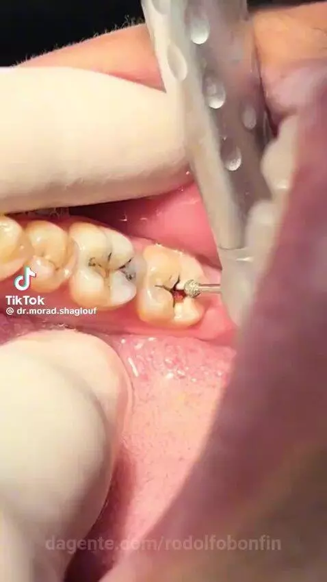 video poster
