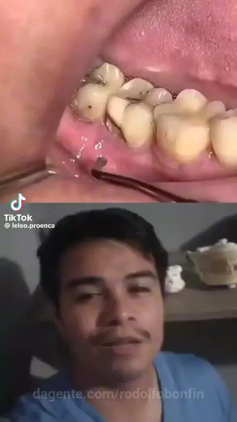 video poster